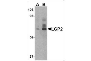 Western blot analysis of LGP2 in rat kidney tissue lysate with this product at (A) 1 and (B) 2 μg/ml. (DHX58 anticorps  (C-Term))