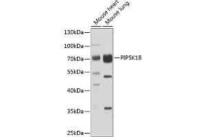 Western blot analysis of extracts of various cell lines, using PIP5K1B antibody (ABIN6130645, ABIN6145684, ABIN6145686 and ABIN6223693) at 1:1000 dilution. (PIP5K1B anticorps  (AA 190-470))