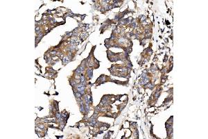 IHC analysis of EPB41L5 using anti-EPB41L5 antibody (ABIN7601550). (EPB41L5 anticorps  (AA 38-733))