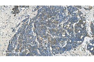 IHC analysis of TIMM8A/DDP using anti-TIMM8A/DDP antibody (ABIN7600039). (TIMM8A/DDP anticorps  (AA 14-97))