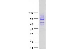Validation with Western Blot