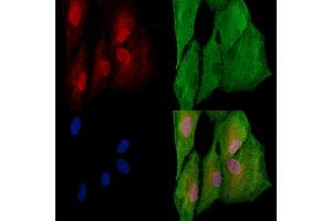 ABIN6264002 and ABIN6277554 staining  cells by IF/ICC.