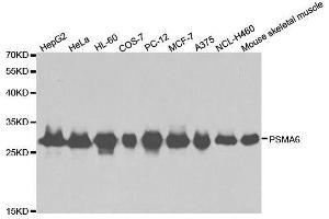 Western blot analysis of extracts of various cell lines, using PSMA6 antibody. (PSMA6 anticorps  (AA 1-246))