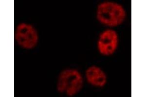 ABIN6267689 staining HT29 by IF/ICC.