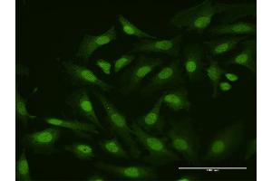 Immunofluorescence of purified MaxPab antibody to HHEX on HeLa cell.