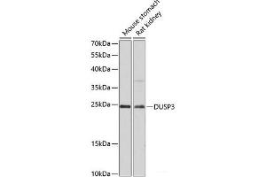 Western blot analysis of extracts of various cell lines using DUSP3 Polyclonal Antibody at dilution of 1:3000. (Dual Specificity Phosphatase 3 (DUSP3) anticorps)