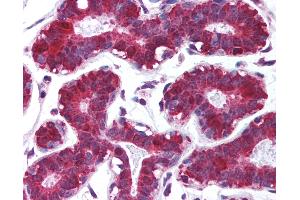 Anti-PDCD4 antibody IHC of human breast.