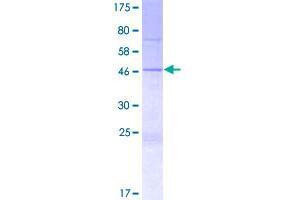 Image no. 1 for Spermatogenesis Associated, Serine-Rich 1 (SPATS1) (AA 1-185) protein (GST tag) (ABIN1321119)