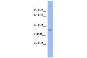 WB Suggested Anti-PSG5 Antibody Titration:  0. (PSG5 anticorps  (Middle Region))