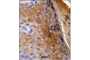 Formalin-fixed and paraffin-embedded human skin reacted with KRT10 Antibody (Center), which was peroxidase-conjugated to the secondary antibody, followed by DAB staining.