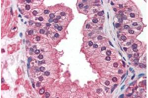 Prostate: Formalin-Fixed, Paraffin-Embedded (FFPE) (IGF1R anticorps)