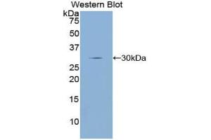 Western blot analysis of the recombinant protein. (Dopamine d2 Receptor anticorps  (AA 194-421))