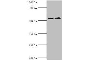 Western blot All lanes: CASP8 antibody at 2 μg/mL Lane 1: ACCM whole cell lysate Lane 2: LO2 whole cell lysate Secondary Goat polyclonal to rabbit IgG at 1/10000 dilution Predicted band size: 56, 54, 46, 58, 28, 26, 33, 31, 62 kDa Observed band size: 56 kDa
