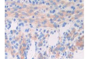 IHC-P analysis of Mouse Uterus Tissue, with DAB staining. (GAD anticorps  (AA 1-97))