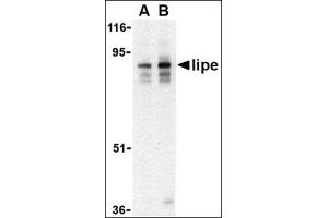 Western blot analysis of lipe in human lymph node tissue lysate with this product at (A) 0. (LIPE anticorps  (C-Term))