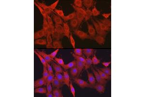 Immunofluorescence analysis of PC-12 cells using Galectin 1/LG Rabbit pAb (ABIN6130424, ABIN6143156, ABIN6143157 and ABIN6218649) at dilution of 1:50 (40x lens). (LGALS1/Galectin 1 anticorps  (AA 1-135))
