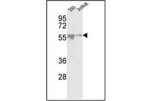 Western blot analysis of CDKL2 antibody (Center) in 293, Jurkat cell line lysates (35ug/lane). (CDKL2 anticorps  (AA 233-263))