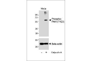 Western blot analysis of lysates from Hela cell line, untreated or treated with EGF(1 μg/mL, 10 min), using Phospho-K1 Antibody (upper) or Beta-actin (lower). (PAK1 anticorps  (pThr423))