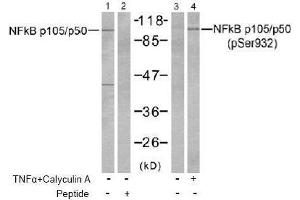 Image no. 2 for anti-Nuclear Factor of kappa Light Polypeptide Gene Enhancer in B-Cells 1 (NFKB1) (pSer932) antibody (ABIN197008) (NFKB1 anticorps  (pSer932))