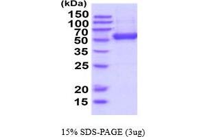 SDS-PAGE (SDS) image for Ectonucleoside Triphosphate diphosphohydrolase 3 (ENTPD3) (AA 44-485) (Active) protein (His tag) (ABIN5854778)
