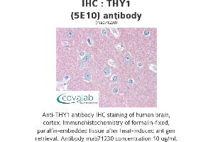 Image no. 2 for anti-CD90 (THY1) antibody (ABIN1724058) (CD90 anticorps)