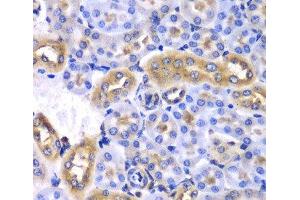 Immunohistochemistry of paraffin-embedded Mouse kidney using SYNCRIP Polyclonal Antibody at dilution of 1:100 (40x lens). (SYNCRIP anticorps)
