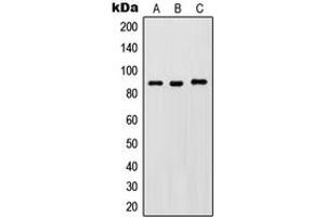 Western blot analysis of IKK beta (pY188) expression in HeLa LPS-treated (A), Raw264. (IKBKB anticorps  (pTyr188))