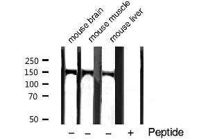 Western blot analysis of extracts of various tissue sample,using Phospho-PLCG1 (Tyr771) Antibody. (Phospholipase C gamma 1 anticorps  (pTyr771))
