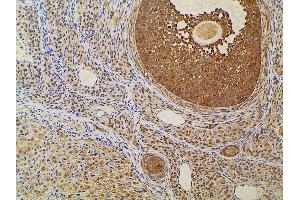 ABIN6277691 at 1/100 staining rat ovarian tissue sections by IHC-P. (Ephrin B2 anticorps  (C-Term))