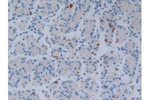 DAB staining on IHC-P; Samples: Human Stomach Tissue (FGF18 anticorps  (AA 28-207))