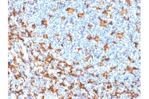 Formalin-fixed, paraffin-embedded human Tonsil stained with AIF1 / Iba1 Mouse Recombinant Monoclonal Antibody (rAIF1/1909).