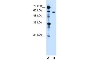 ZDHHC13 antibody used at 1. (ZDHHC13 anticorps  (N-Term))