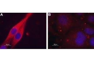 Expression of Muscarinic acetylcholine receptor M4 in C6 transfected cells - Immunocytochemical staining of paraformaldehyde-fixed and permeabilized C6 cells.