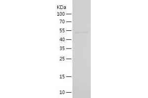 Western Blotting (WB) image for Choline O-Acetyltransferase (CHAT) (AA 323-575) protein (His-IF2DI Tag) (ABIN7122357)