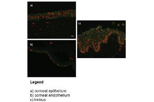 WB Suggested Anti-DPYS (dihydropyrimidinase) Antibody (Clone #:8B11)(100ug)   Titration: 0.
