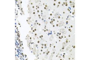 Immunohistochemistry of paraffin-embedded mouse brain using MCL1 antibody at dilution of 1:100 (x40 lens). (MCL-1 anticorps)