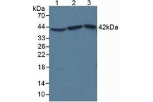 SDS-PAGE of Protein Standard from the Kit (Highly purified E. (beta Actin Kit ELISA)