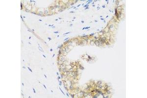 Immunohistochemistry of paraffin-embedded Human prostate using KIAA1456 Polyclonal Antibody at dilution of 1:200 (40x lens).