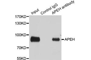 Immunoprecipitation analysis of 100ug extracts of SW480 cells using 3ug APEH antibody.