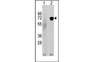 Western blot analysis of CAMKK2 (arrow) using rabbit polyclonal CAMKK2 Antibody (CAMKK2 anticorps  (N-Term))