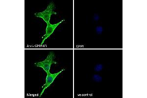(ABIN768598) Immunofluorescence analysis of paraformaldehyde fixed A431 cells, permeabilized with 0.