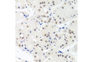 Immunohistochemistry of paraffin-embedded human stomach using HMGN1 antibody (ABIN5975005) at dilution of 1/100 (40x lens). (HMGN1 anticorps)