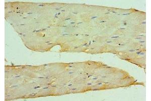 Immunohistochemistry of paraffin-embedded human skeletal muscle tissue using ABIN7149059 at dilution of 1:100 (KAT14 anticorps  (AA 523-782))