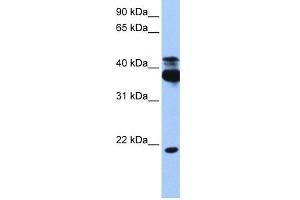 WB Suggested Anti-STK38 Antibody Titration:  0. (STK38 anticorps  (C-Term))