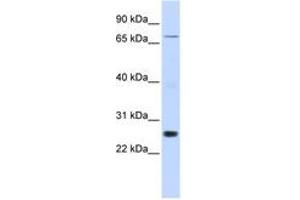 Image no. 1 for anti-Zinc Finger Protein 267 (ZNF267) (AA 288-337) antibody (ABIN6742593) (ZNF267 anticorps  (AA 288-337))