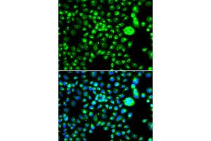 Immunofluorescence analysis of MCF7 cell using SMCHD1 antibody. (SMCHD1 anticorps)