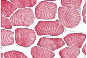 Human Skeletal Muscle: Formalin-Fixed, Paraffin-Embedded (FFPE) (FBXO32 anticorps  (C-Term))