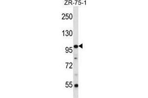 ZNF845 Antibody (N-term) western blot analysis in ZR-75-1 cell line lysates (35 µg/lane). (ZNF845 anticorps  (N-Term))