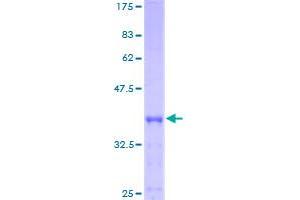 Image no. 1 for Acylphosphatase 1, Erythrocyte (Common) Type (Acyp1) (AA 1-99) protein (GST tag) (ABIN1305827)