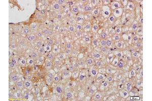 anti-AKT 1/2/3 (pTyr312), (pTyr315), (pTyr316) antibody